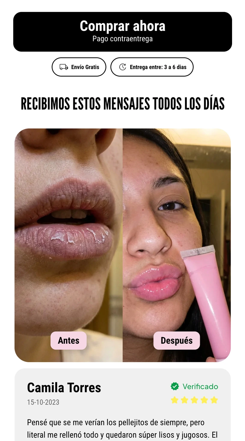 embudo-carrusel-img-13